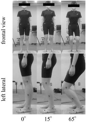 Change in sensory integration and regularity of postural sway with the suspensory strategy during static standing balance